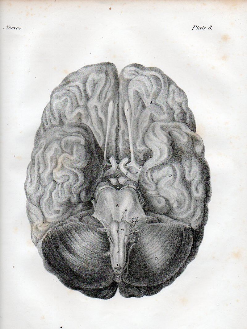 Brain527