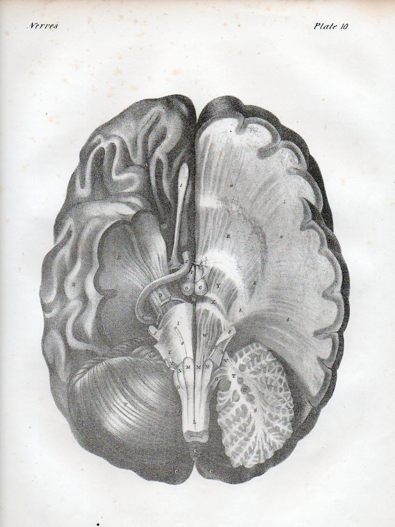 Brain529
