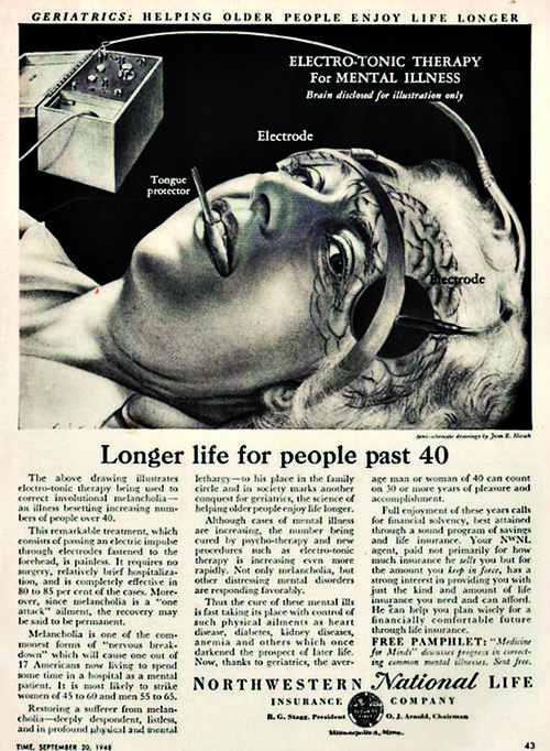 ECT therapy
