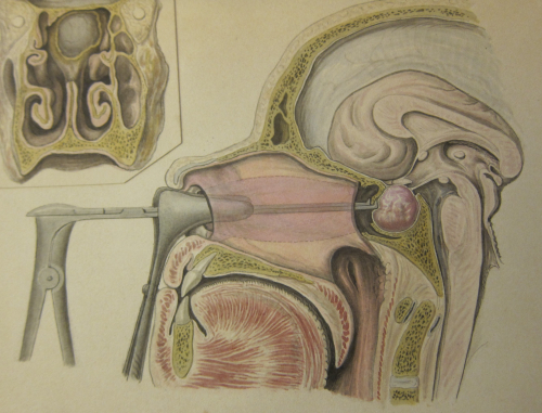 Pituitary _2 3d_