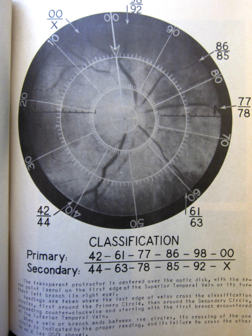 Retina pattern