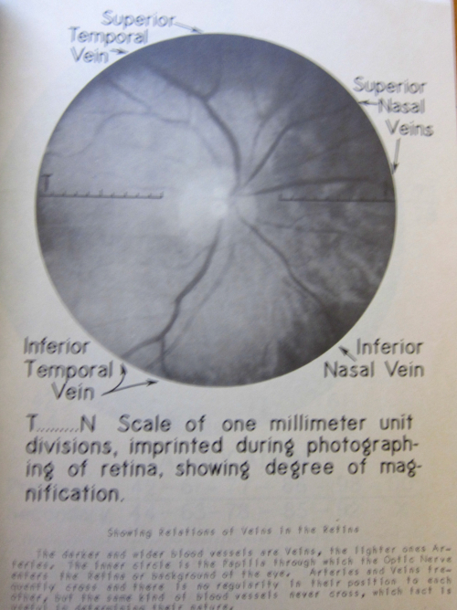 Retina id _2_