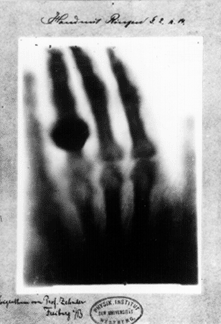 Blog--july 9--roentgen