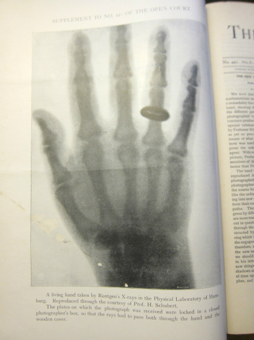 X-ray _2_ X-ray _2_