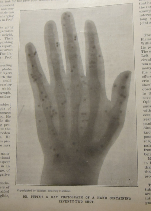 Sci Am 1896 x-ray